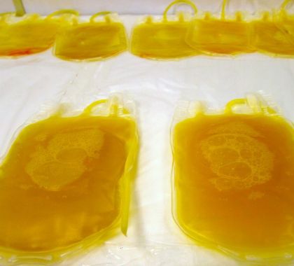 MS vai usar plasma de sangue humano no tratamento da Covid-19